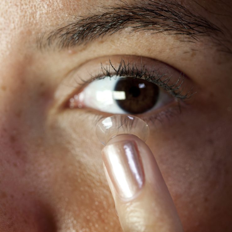 Do I need a contact lens consultation?