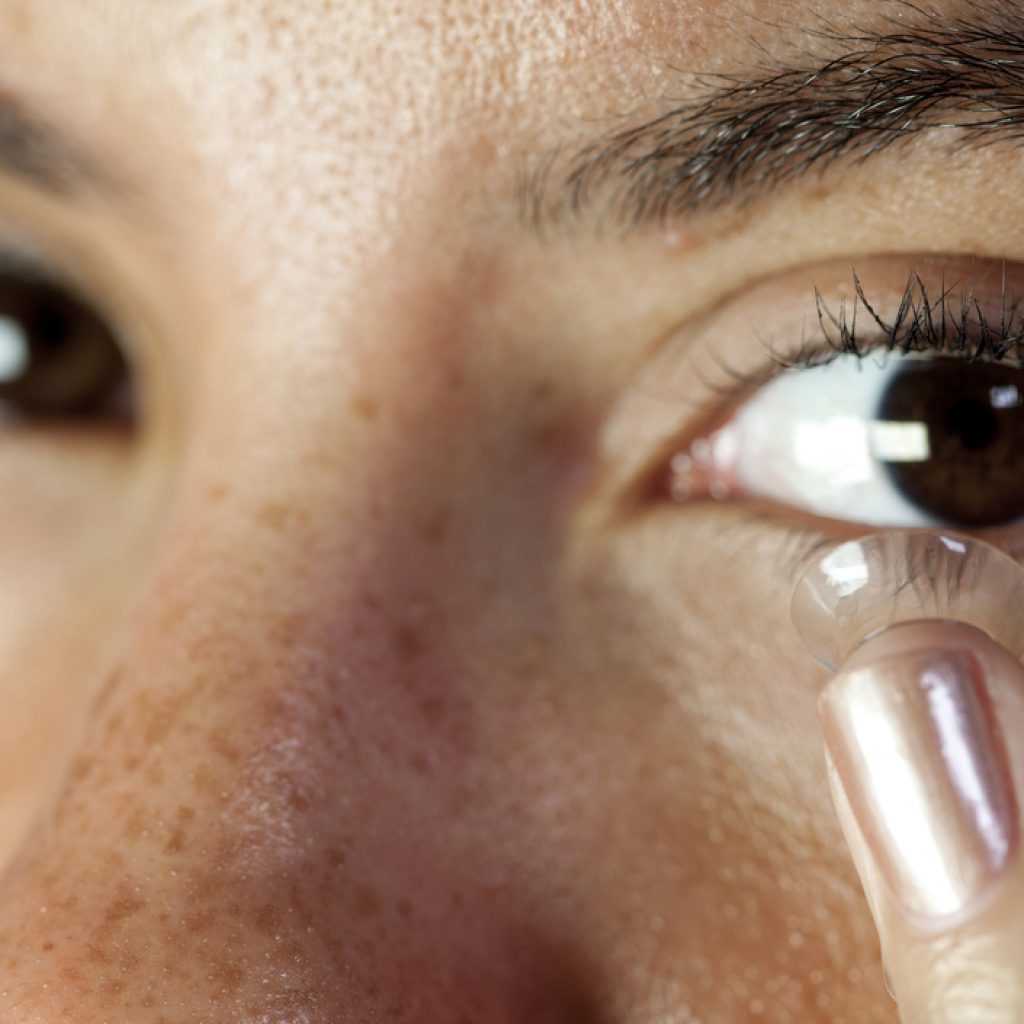 contact lens consultation